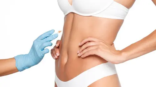 plastiskā ķirurģija pēc aizkariem